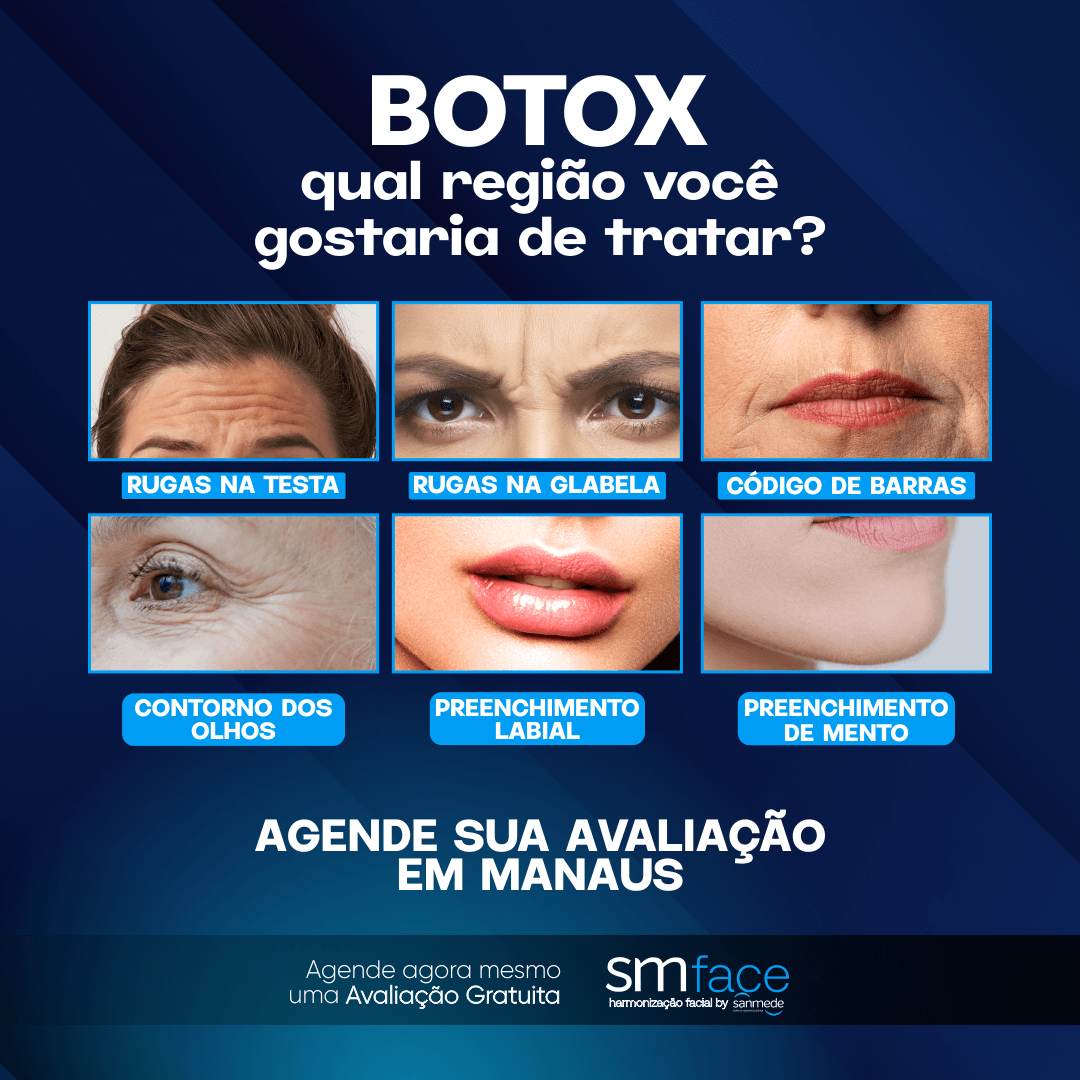 ads - qual região você gostaria de tratar